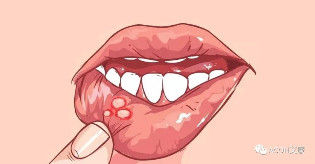 哪些小病容易让人忽视，最后造成越拖越严重呢？