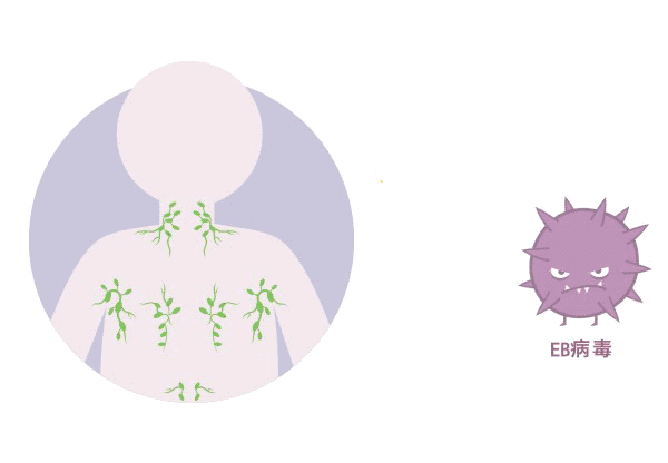 体检查出“EB病毒”阳性！一定就是鼻咽癌吗？