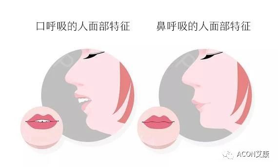 过敏性鼻炎会让孩子变傻？！家长该如何应对